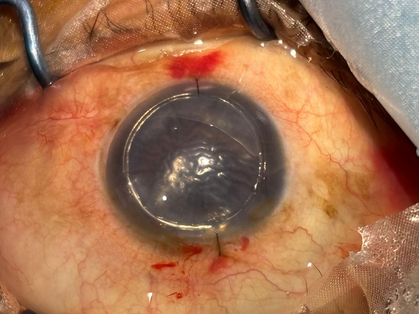 In-house optical lab